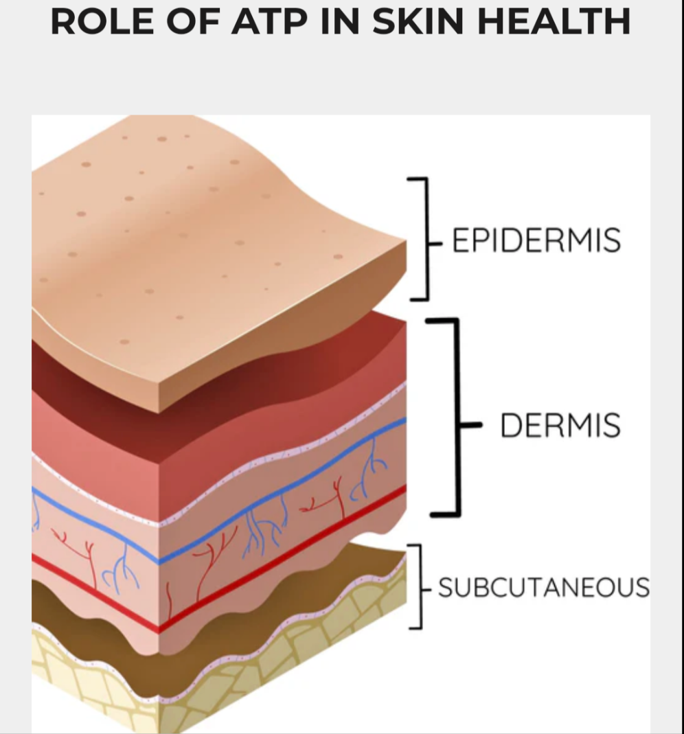 Myolift QT plus pre-sell