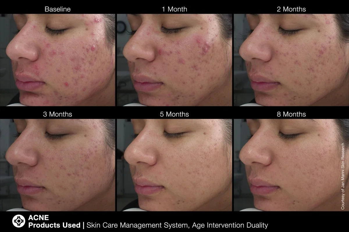 Age Intervention® Duality™