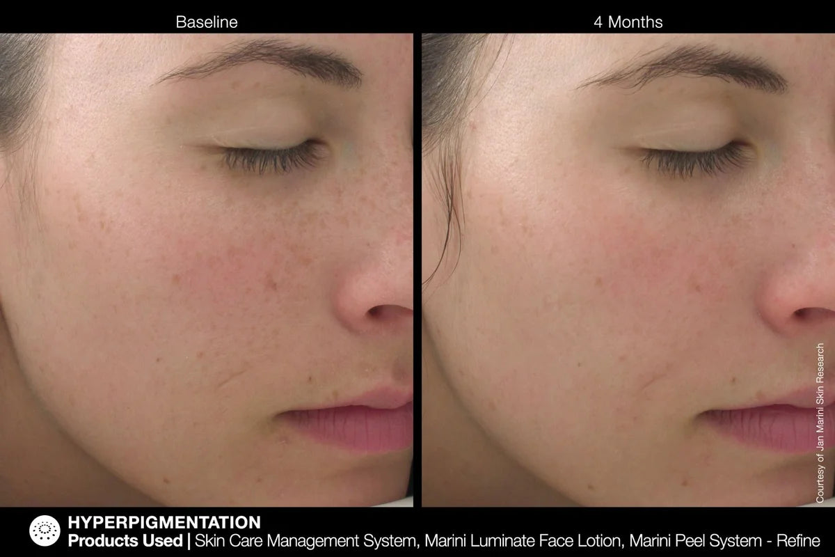 Marini Luminate® Face Lotion