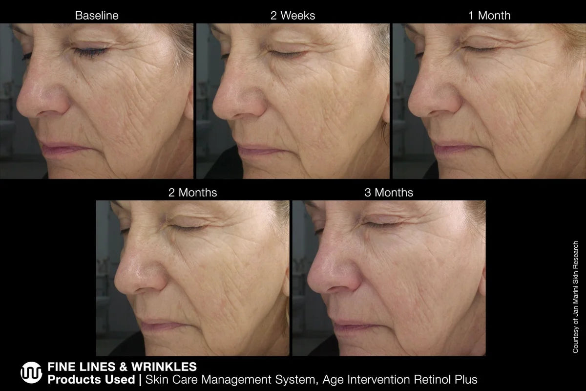 Age Intervention® Retinol Plus